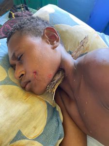 Patient with stick through his neck